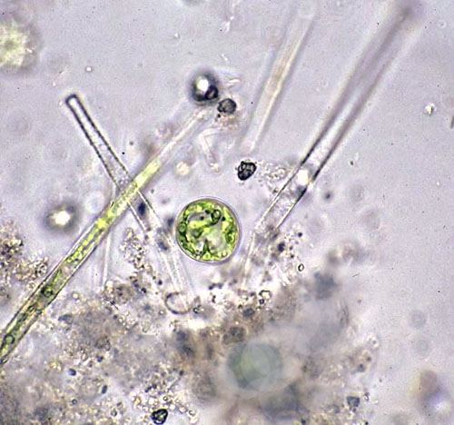 Gonatozygon brebissonii, zygospore
