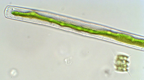 Detail of same cell showing plate like chloroplast