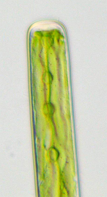 Haplotaenium rectum, detail of cell apex