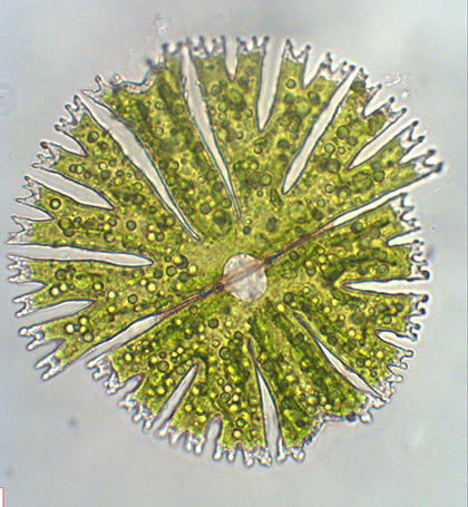 Micrasterias radiosa, dividing cell