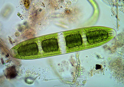 another cell of Netrium digitus