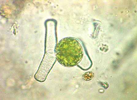 Penium exiguum zygospore