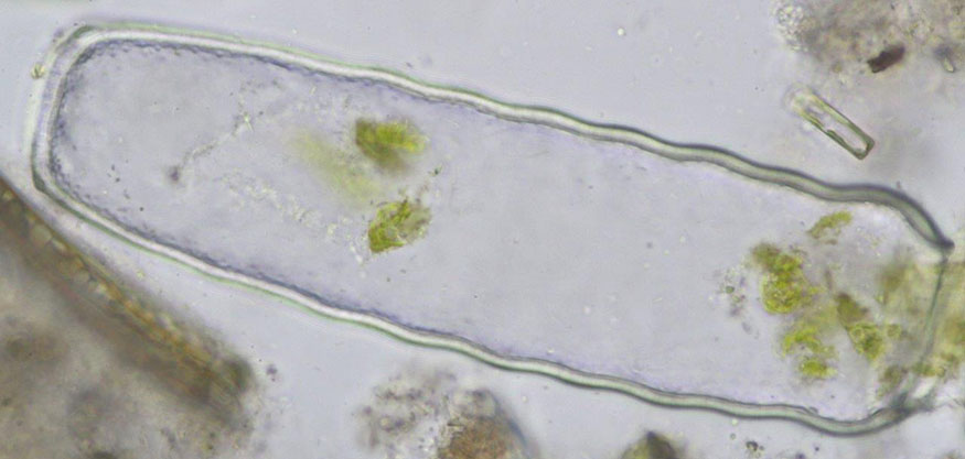 Pleurotaenium nodulosum, dead semicell