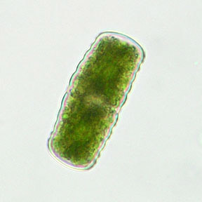 Cosmarium annulatum var. elegans