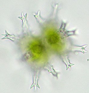 Staurastrum sexangulare (frontal view)