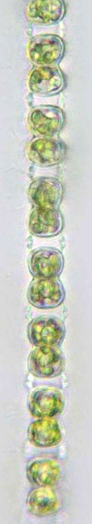 Sphaerozosma aubertianum, interconnecting apicall cell  processes