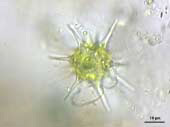 Sphaerozosma aubertianum, spiny zygospore