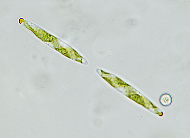 two other cells of Spirotaenia erythrocephala