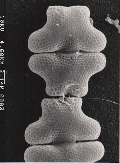 Spondylosium pulchellum, SEM image
