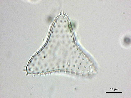 Staurastrum brebissonii, empty semicell