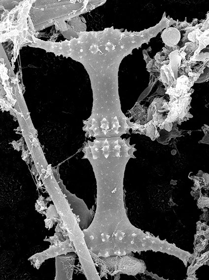 Staurastrum elongatum, SEM image