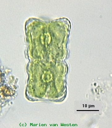Staurastrum pileolatum