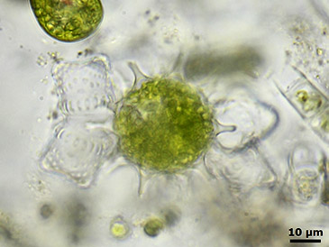 Zygospore of Staurastrum pileolatum