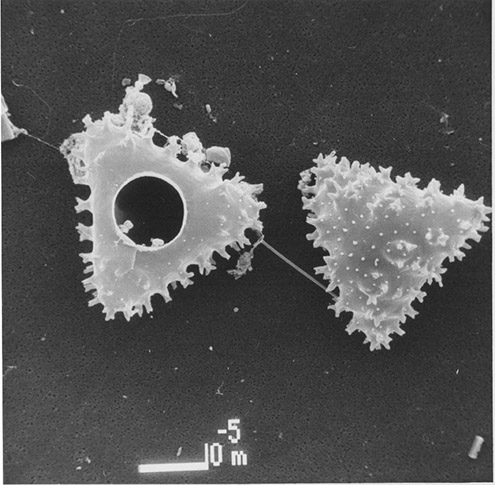 Staurastrum scabrum, SEM image, apical view