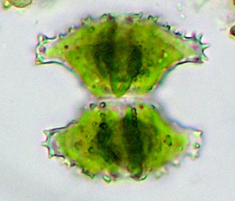 Staurastrum sexcostatum, 5-radiate cell in frontal view