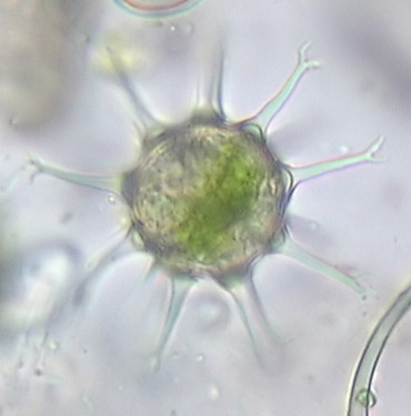 Staurastrum furcatum, zygospore