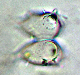 Staurastrum furcatum var. aciculiferum, empty cell