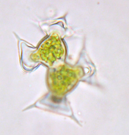 Staurodesmus pterosporus, conjugating cells