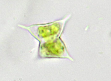 Staurodesmus pterosporus, biradiate vegetative cell