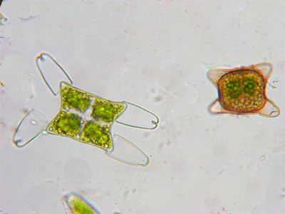 Tetmemorus laevis, immature and maturuezygospore